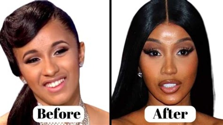 
Yazmin Oukhellou Before And After Surgery: Has She Had A Nose Job? 